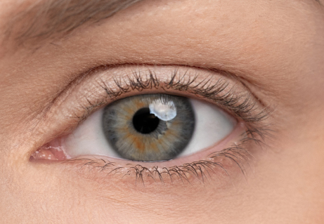 Close-up of an eye with short, sparse eyelashes before treatment
